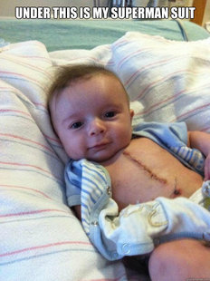 Ridiculously Goodlooking Surgery Baby