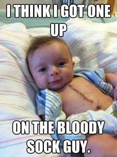 Ridiculously Goodlooking Surgery Baby
