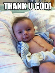 Ridiculously Goodlooking Surgery Baby