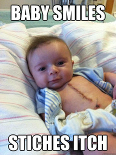 Ridiculously Goodlooking Surgery Baby