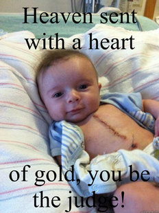 Ridiculously Goodlooking Surgery Baby