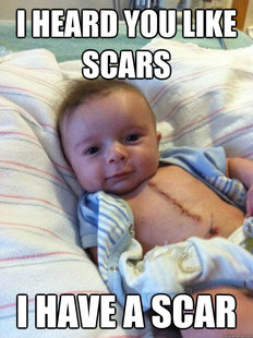 Ridiculously Goodlooking Surgery Baby