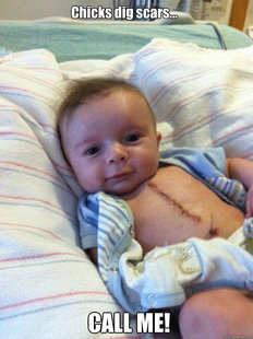Ridiculously Goodlooking Surgery Baby
