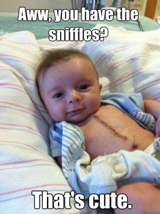 Ridiculously Goodlooking Surgery Baby