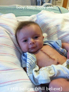 Ridiculously Goodlooking Surgery Baby